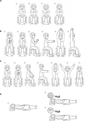 Yijinjing Qigong intervention shows strong evidence on clinical effectiveness and electroencephalography signal features for early poststroke depression: A randomized, controlled trial